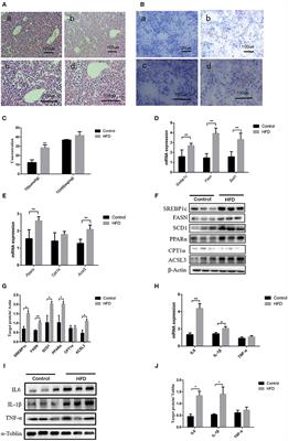 Maternal High-Fat Diet Leads to Non-alcoholic Fatty Liver Disease Through Upregulating Hepatic SCD1 Expression in Neonate Rats